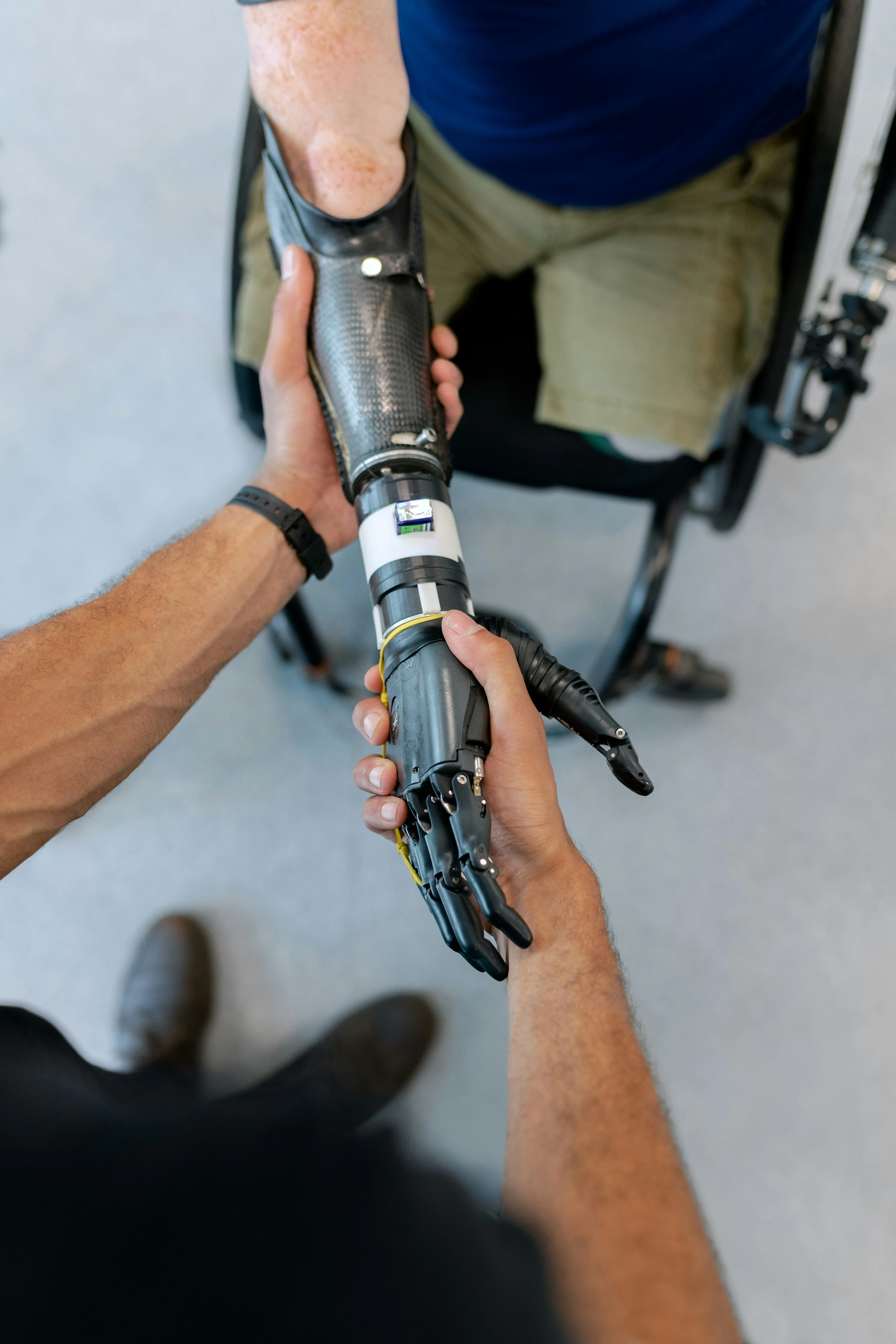 Patient with prosthetic limb